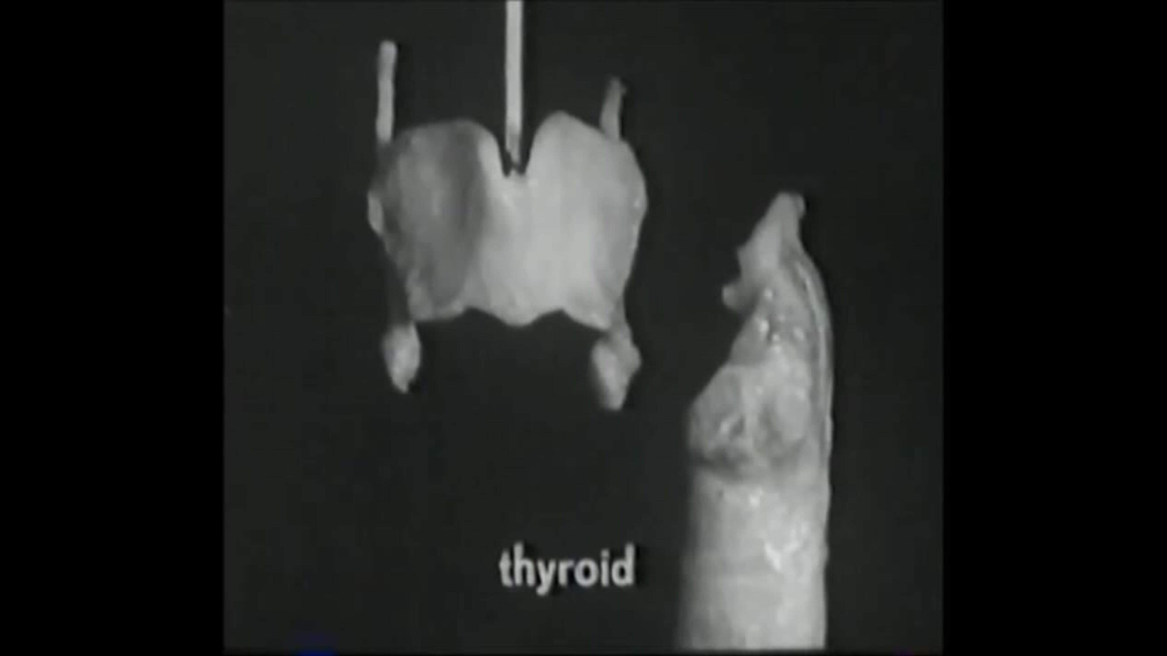 Voice Production: The Vibrating Larynx